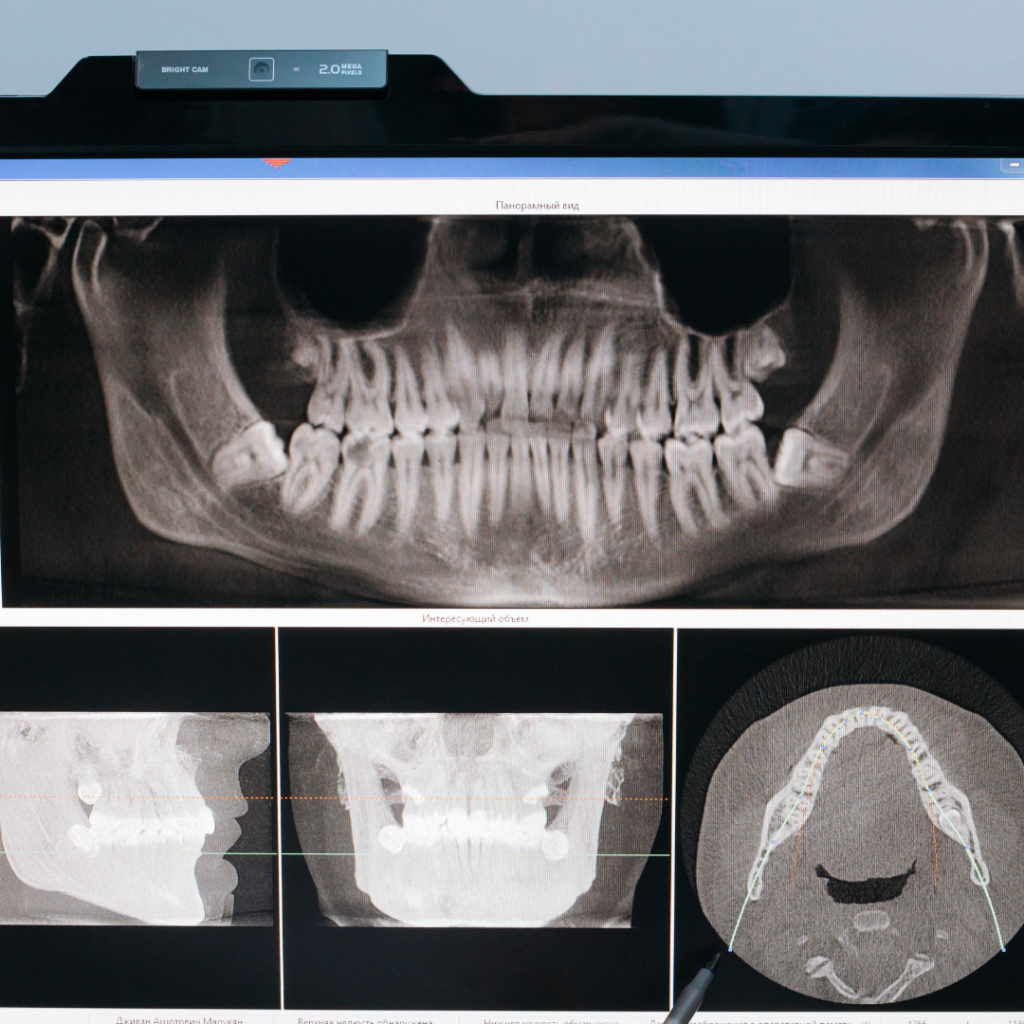Orthodontic consultation with X-ray diagnostics — PLN 250