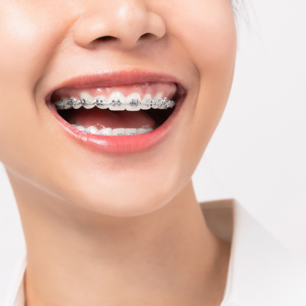 Surgical and implantology consultation with CT for PLN 350!