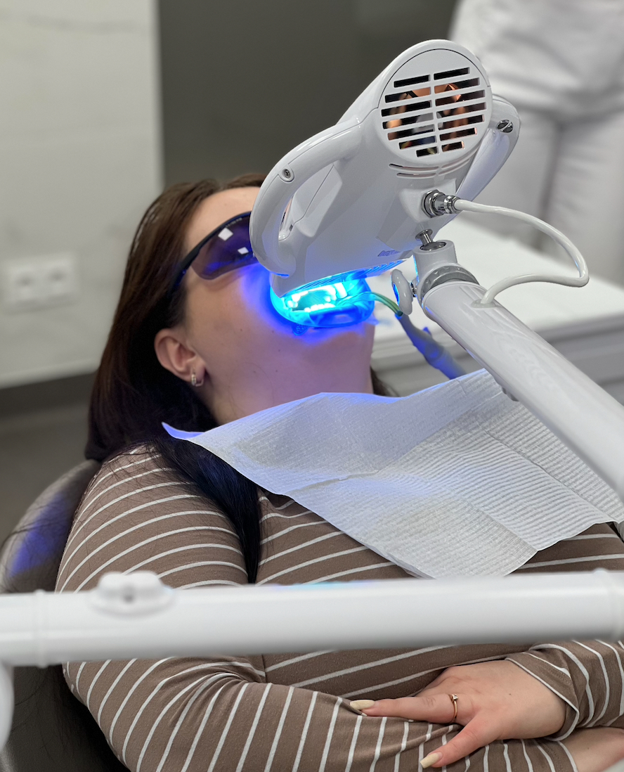 Відбілювання зубів Beyond