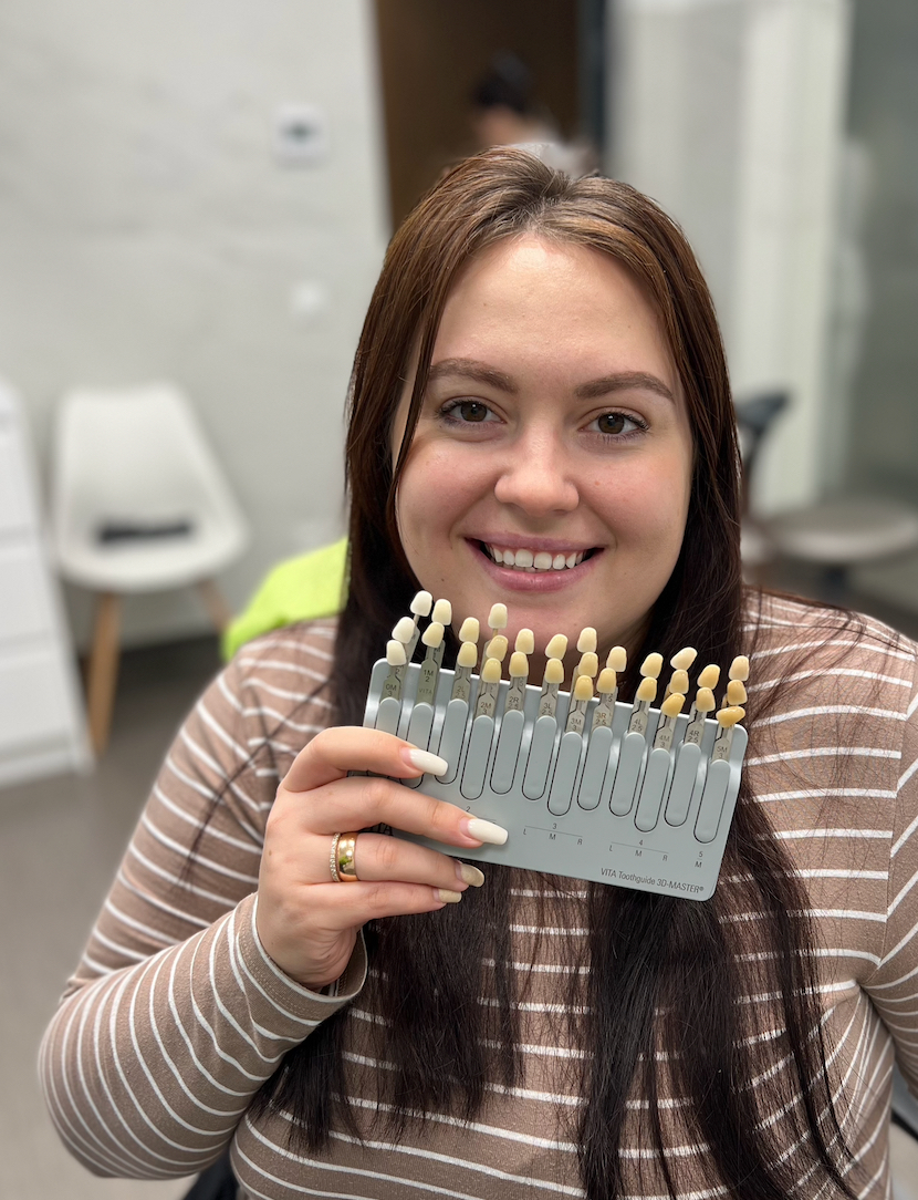 Відбілювання зубів Beyond